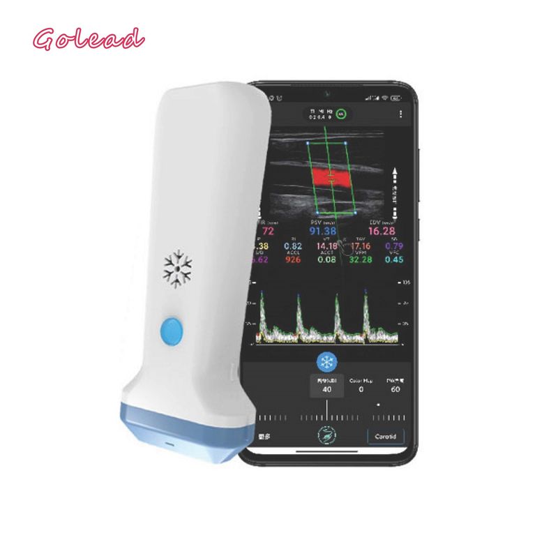 Sondetype van 12MHz 3000mAh Draadloze Ultrasone klankscanner voor Iphone