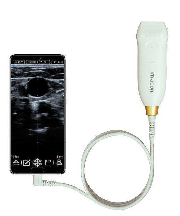 64 Kanaal 20 mm diepte handheld ultrasound scanner voor perifere vasculaire beoordeling en ultrasound-geleide vasculaire toegang