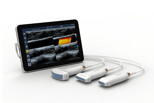 10MHz draagbare Draadloze Android-Ultrasone klankscanner met Verbinding type-C