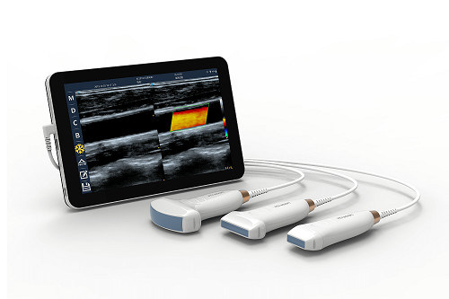 USB Type-C lineaire handheld echografiescanner 10 MHz draagbare Android-echografiesonde voor vasculaire en POCUS