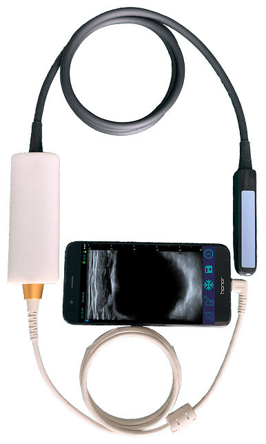 Handheld veterinaire echografiescanner met lineaire rectale sonde voor de voortplanting van runderen en paarden