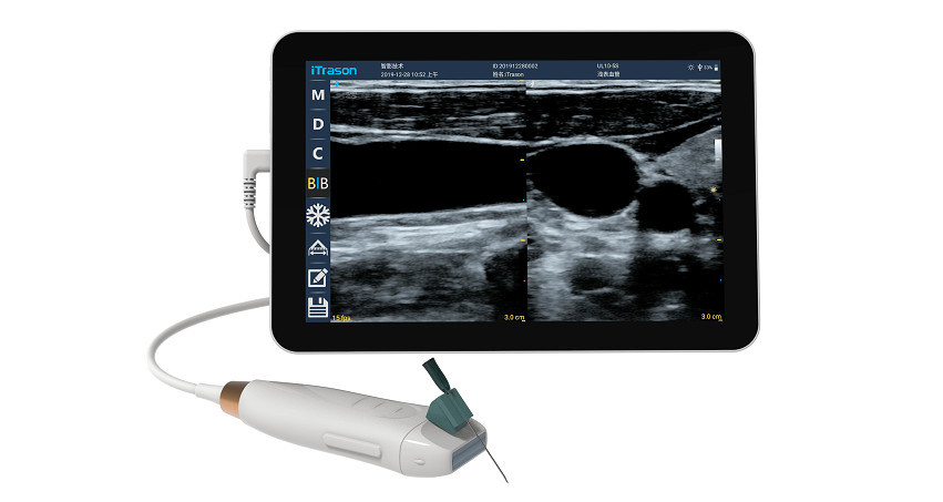 Handheld ultrasound scanner met 12 MHz High Frequency Linear Probe voor nauwkeurige vasculaire toegang en PICC-invoegprocedures