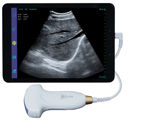 Elektronische Convexe Handbediende de Ultrasone klankscanner 3.5MHz van Doppler van de Seriekleur