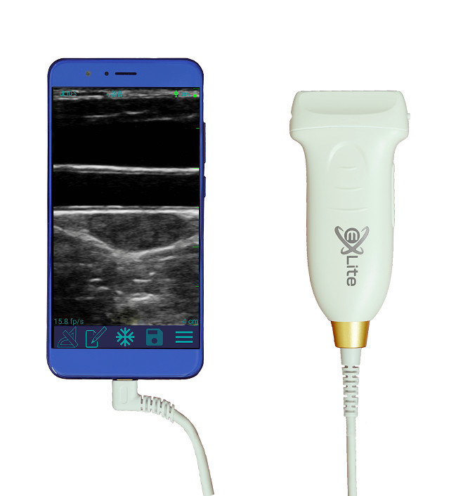 USB Type-C lineaire handheld echografiescanner 10 MHz draagbare Android-echografiesonde voor vasculaire en POCUS
