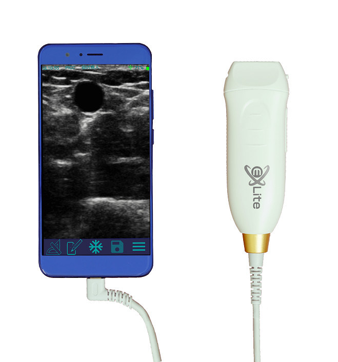 Handheld ultrasound scanner met 12 MHz High Frequency Linear Probe voor nauwkeurige vasculaire toegang en PICC-invoegprocedures