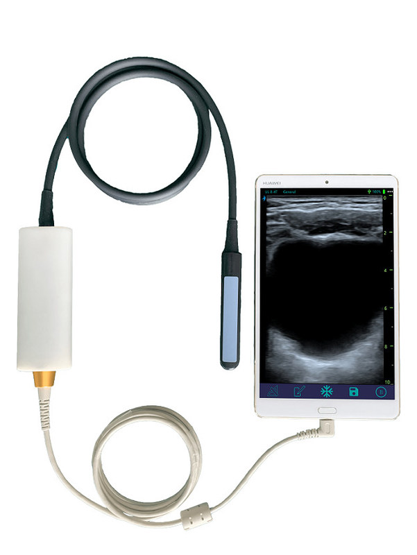 Handheld veterinaire echografiescanner met lineaire rectale sonde voor de voortplanting van runderen en paarden