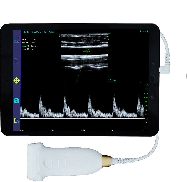 10MHz draagbare Draadloze Android-Ultrasone klankscanner met Verbinding type-C