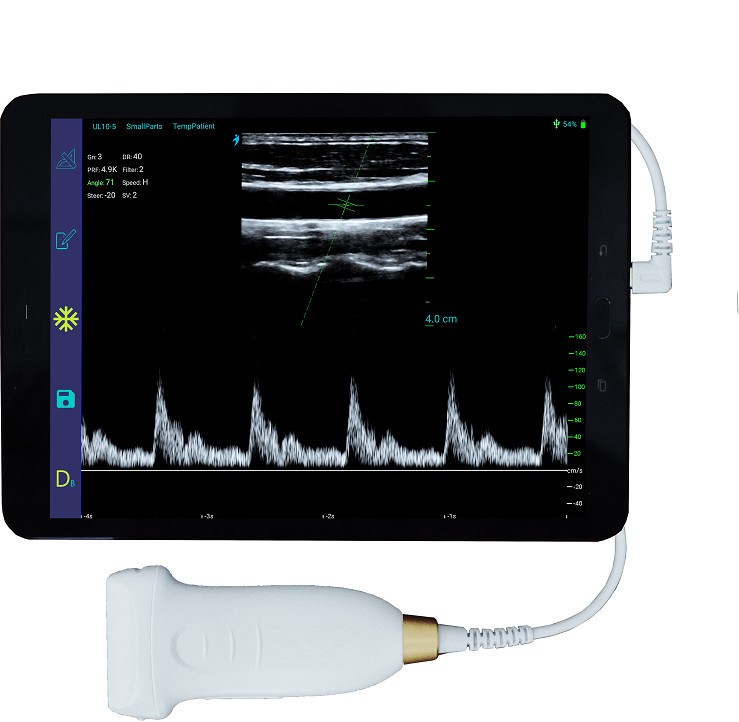 USB Type-C lineaire handheld echografiescanner 10 MHz draagbare Android-echografiesonde voor vasculaire en POCUS