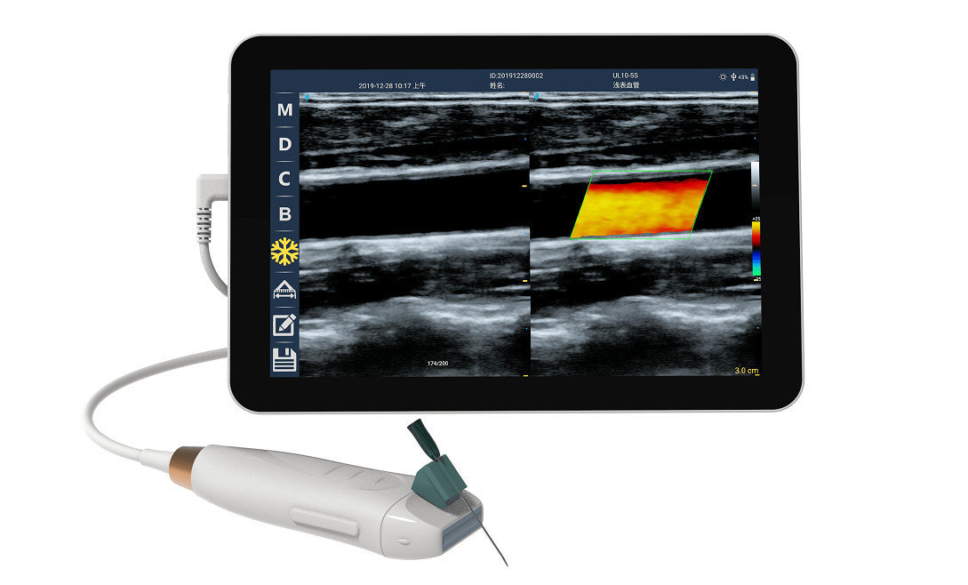 Handheld ultrasound scanner met 12 MHz High Frequency Linear Probe voor nauwkeurige vasculaire toegang en PICC-invoegprocedures
