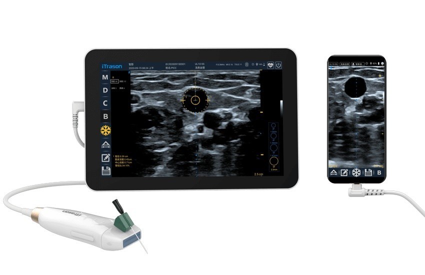 64 Kanaal 20 mm diepte handheld ultrasound scanner voor perifere vasculaire beoordeling en ultrasound-geleide vasculaire toegang