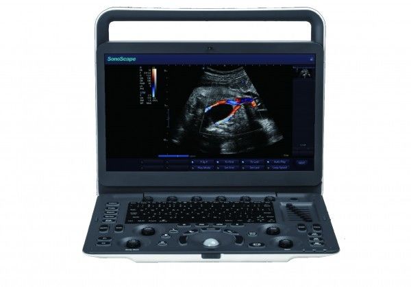7 Draagbare de Ultrasone klankmachine van SonoScape E3 van weergaveniveaus met 15,6 Duimmonitor