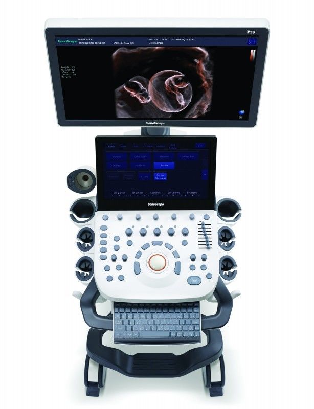 21.5 de Ultrasone klankmachine van Doppler van de het“ LEIDENE Karretjekleur van Sonoscape P10