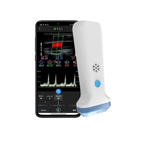 12.6cm Draagbare de Ultrasone klankscanner van Kleurendoppler voor Beroepsbeoefenaars