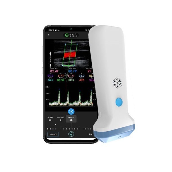Draagbare kleurendoppler draadloze lineaire echografiescanner 12,6 cm handheld POCUS-echografie voor professionals in de gezondheidszorg