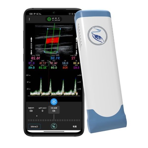 Echo Color Doppler Wireless Handheld-Ultrasone klankscanner 100 Kaders