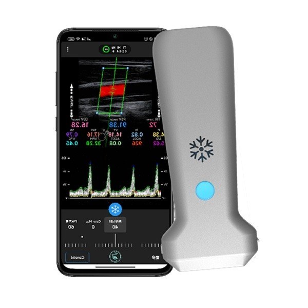 CE-gecertificeerde draadloze lineaire handheld echografiescanner | 8,3 MHz draagbare kleurendoppler-echografiesonde