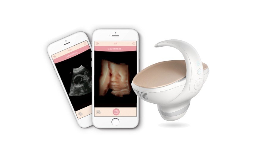 CE-goedgekeurde 3D/4D draagbare foetale echografie
Draagbare zwangerschapsbeeldopname-oplossing met 60° breedhoekige convexe sonde