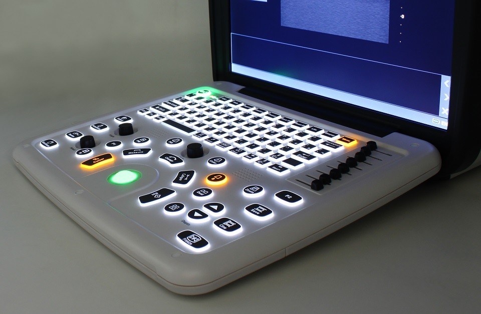 DCU10 draagbaar kleurendoppler-echografiesysteem met 15-inch HD-display voor verloskundige/gyn-, buik- en hartbeeldvorming