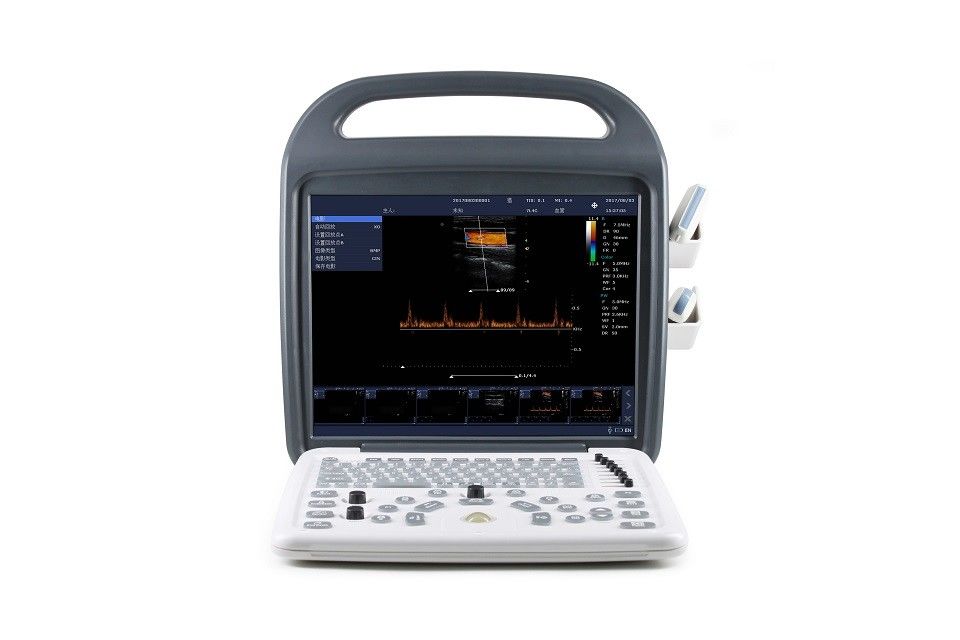 15“ Hoge Definitielcd de Ultrasone klankmachine Draagbare 7.5kg van Doppler van de Monitorkleur