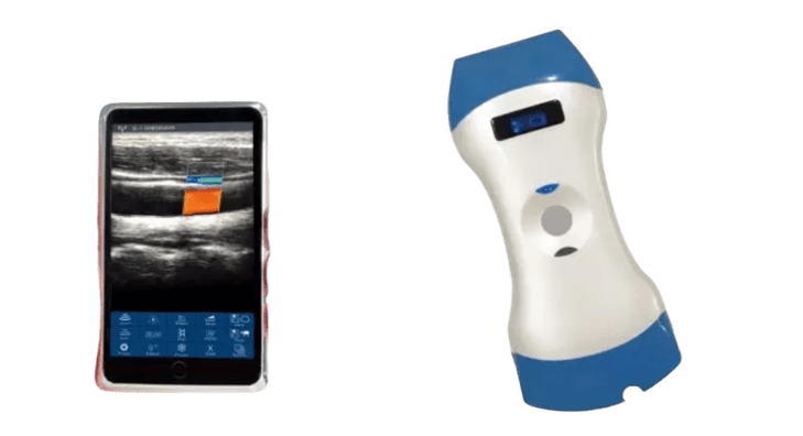 Draadloze draagbare ultrasone sonde met 128 elementen en dubbele kop – één sonde voor diepe beeldvorming, oppervlakkige beeldvorming en point-of-care-diagnose