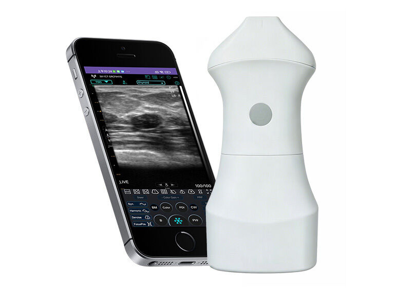 24 MHz hoogfrequente huid-echografiesonde voor esthetische geneeskunde, dermatologie en begeleiding van injecteerbare procedures