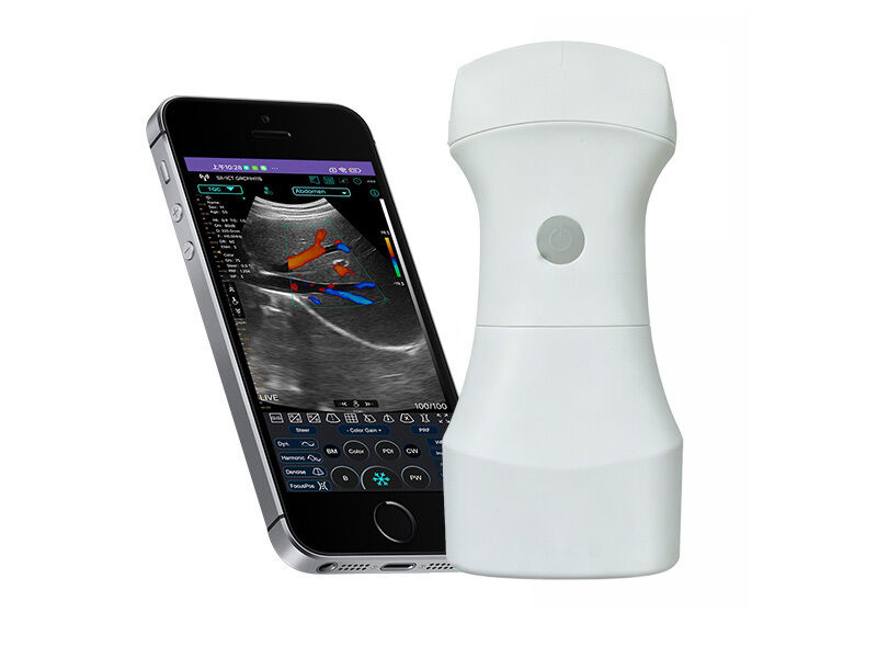Draadloze Pocket Convexe Ultrasound Scanner met vervangbare batterij voor draagbare klinische beeldvorming