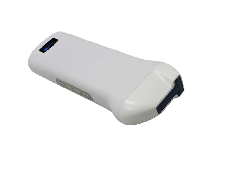 Draadloze hoogfrequente lineaire echografiescanner met naaldgeleiding in en buiten het vliegtuig voor zenuwblokkades
