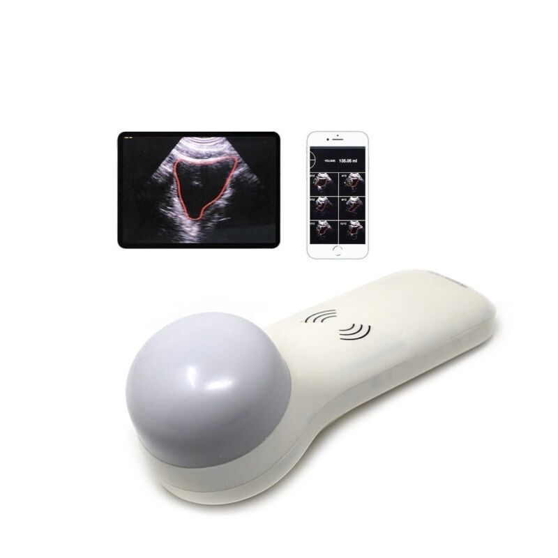 Draadloze 4D draagbare blaasscanner voor point-of-care urinevolumemeting